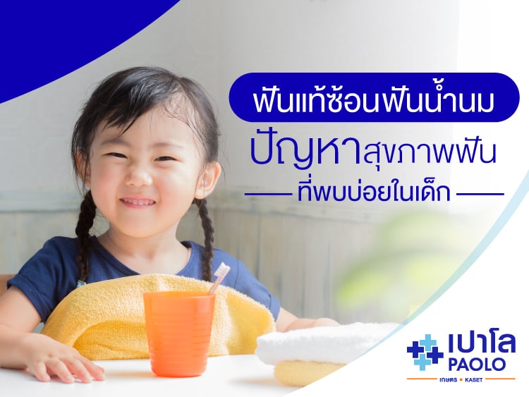 ฟันแท้ซ้อนฟันน้ำนม ปัญหาสุขภาพฟันที่พบบ่อยในเด็ก