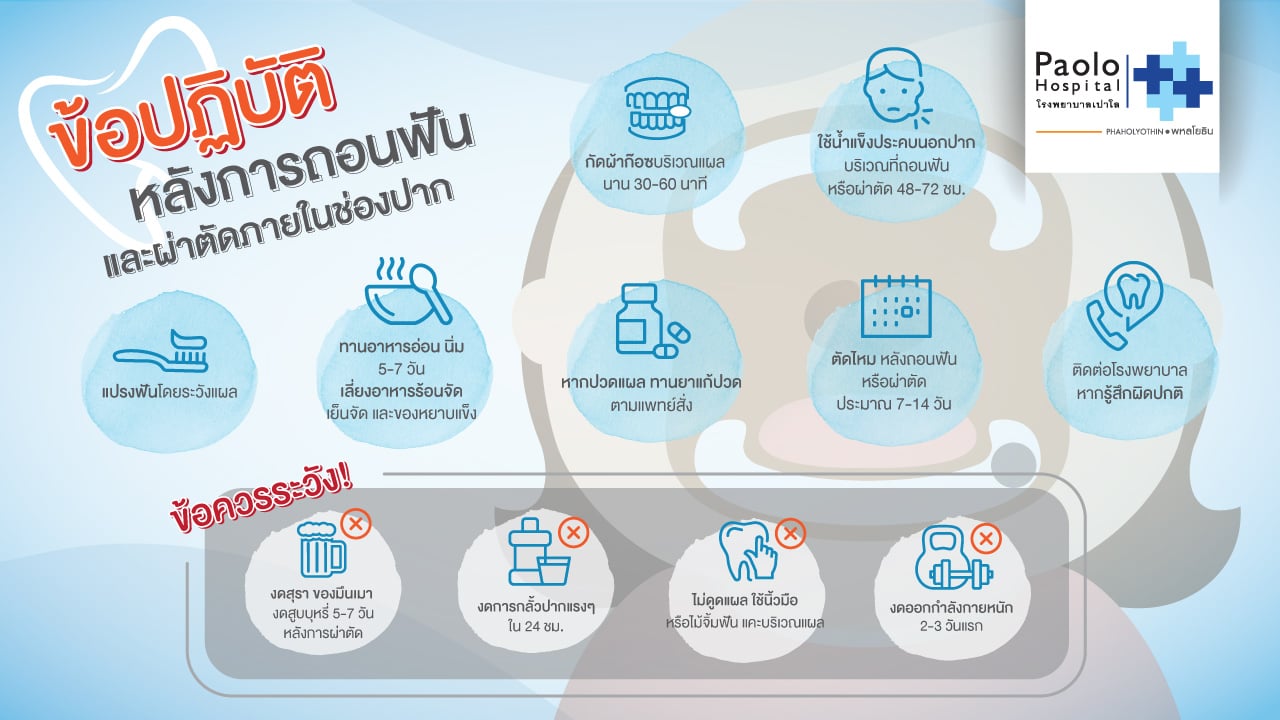 ดูแลตัวเองอย่างไร? หลังการถอนฟัน และผ่าตัดภายในช่องปาก | โรงพยาบาลเปาโล - Paolo Hospital ดูแลตัวเองอย่างไร? หลังการถอนฟัน และผ่าตัดภายในช่องปาก | โรงพยาบาลเปาโล - Paolo Hospital