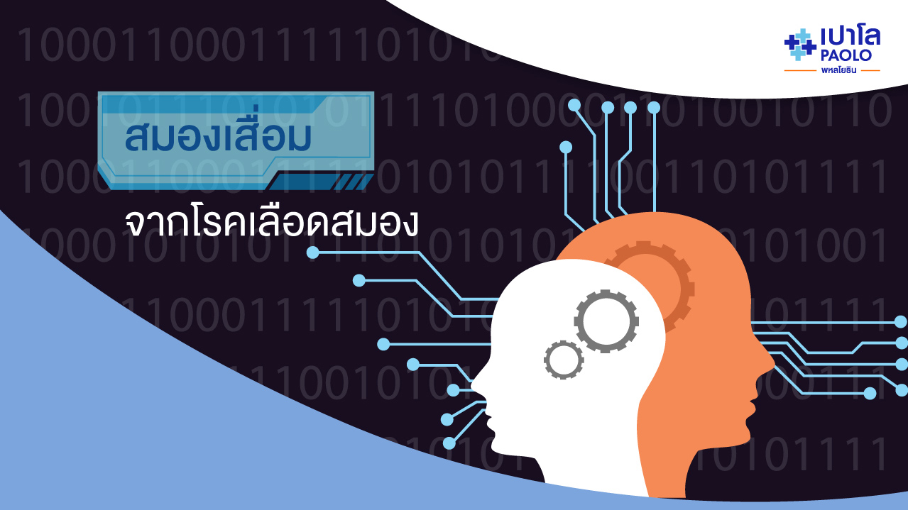 สมองเสื่อมจากโรคหลอดเลือดสมอง (Vascular Dementia)