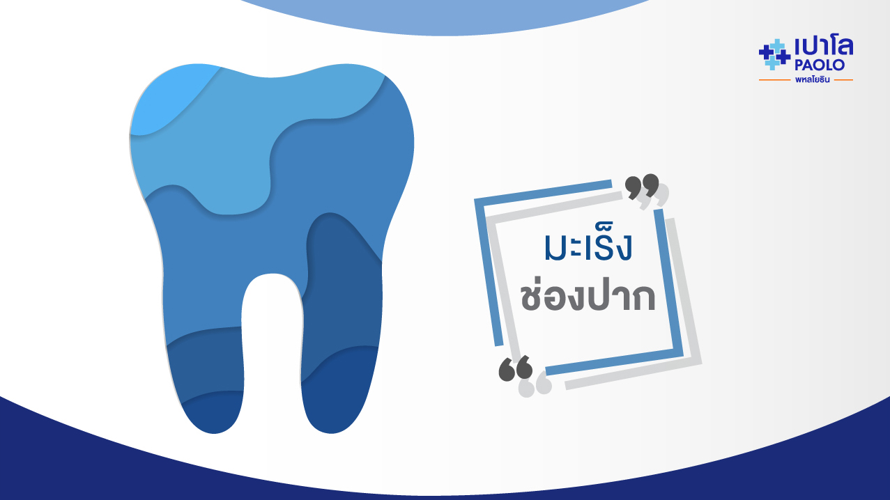 รักษา “มะเร็งช่องปาก” อย่างไรได้บ้าง?