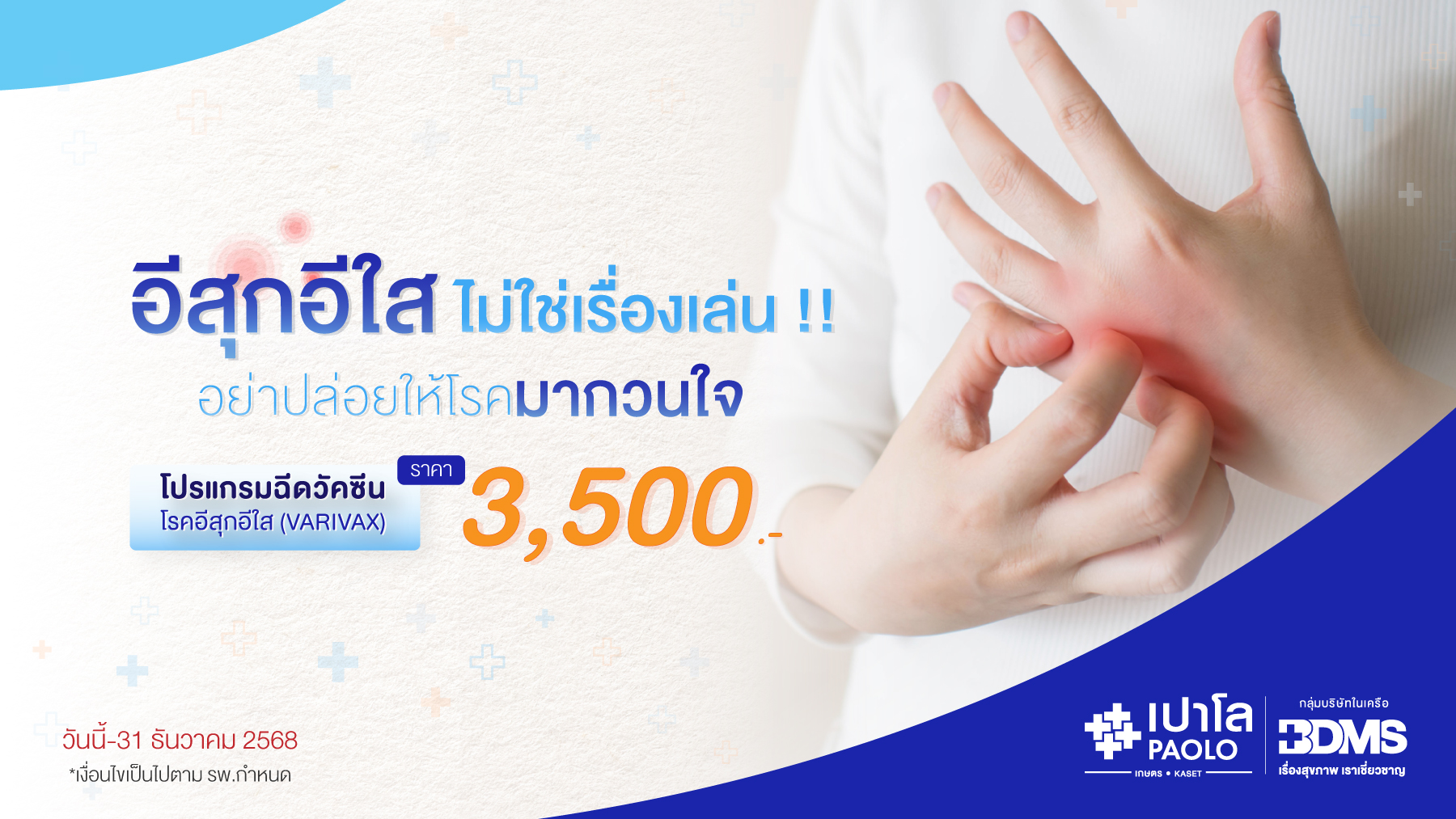 โปรแกรมวัคซีนป้องกันโรคอีสุกอีใส 