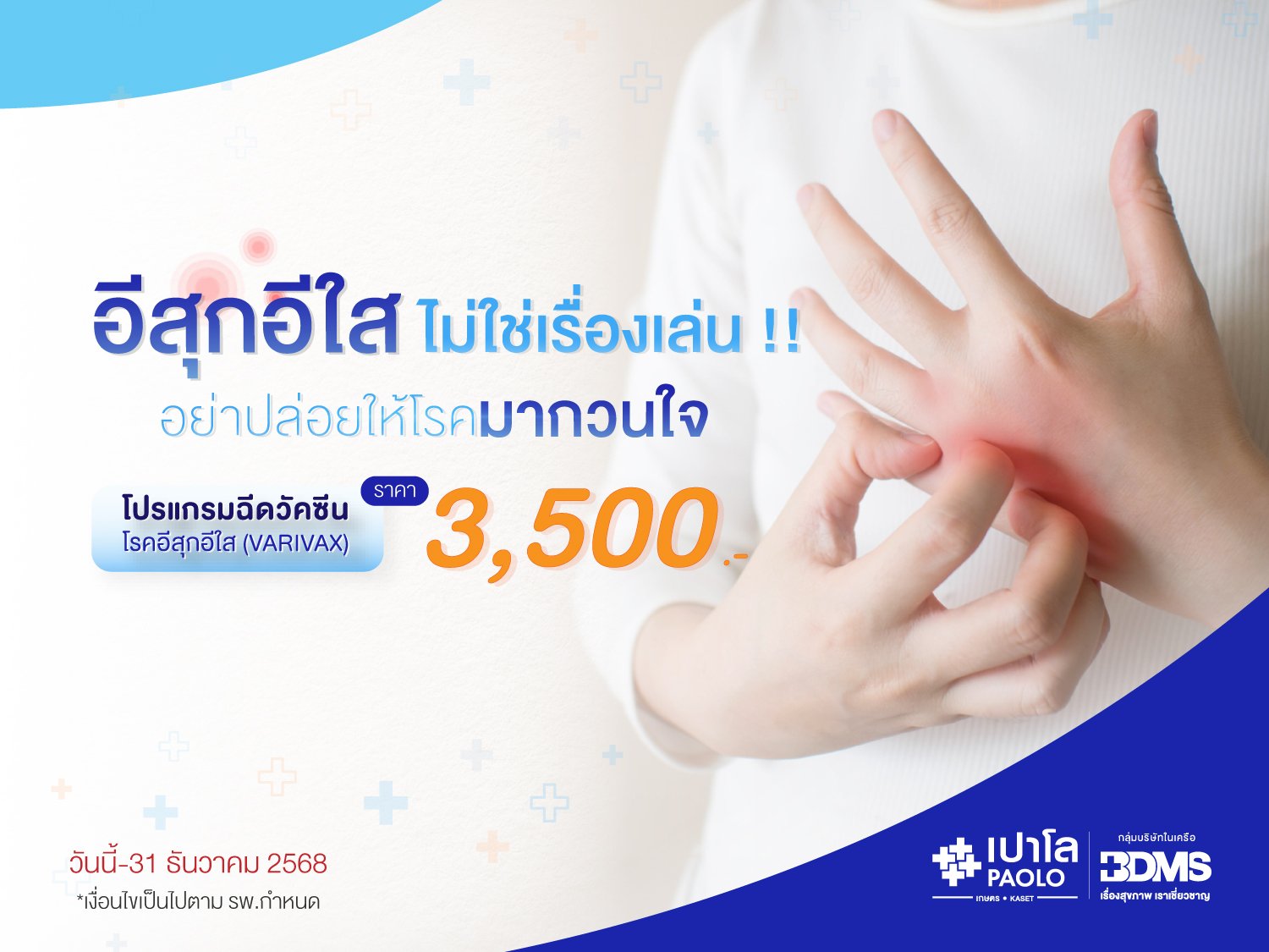 โปรแกรมวัคซีนป้องกันโรคอีสุกอีใส 