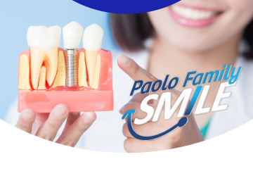 Paolo Family Teens Smile รากฟันเทียมดิจิตอล