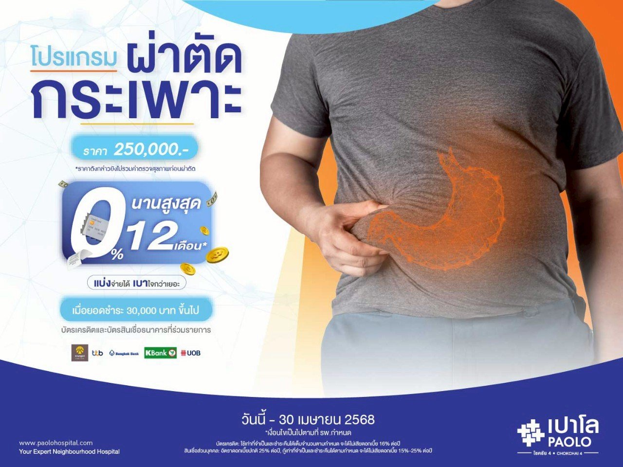 โปรแกรมผ่าตัดกระเพาะ ผ่อน0%นาน12เดือน