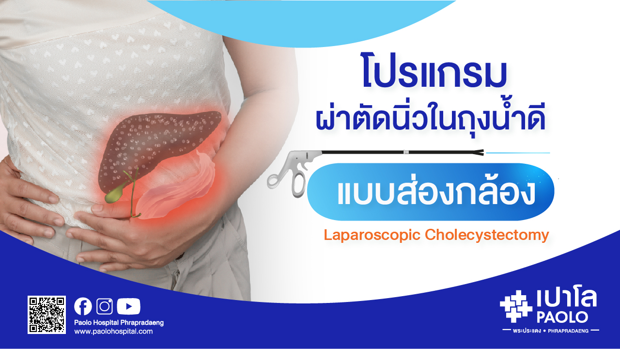 โปรแกรมผ่าตัดนิ่วในถุงน้ำดีแบบส่องกล้อง