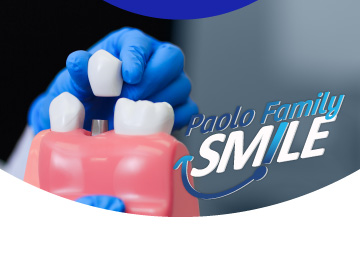Paolo Family Teens Smile ครอบฟันระบบดิจิตอล