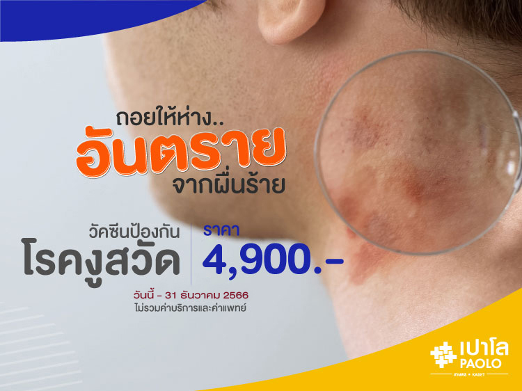 วัคซีนป้องกันโรคงูสวัด (ZOSTAVAX)